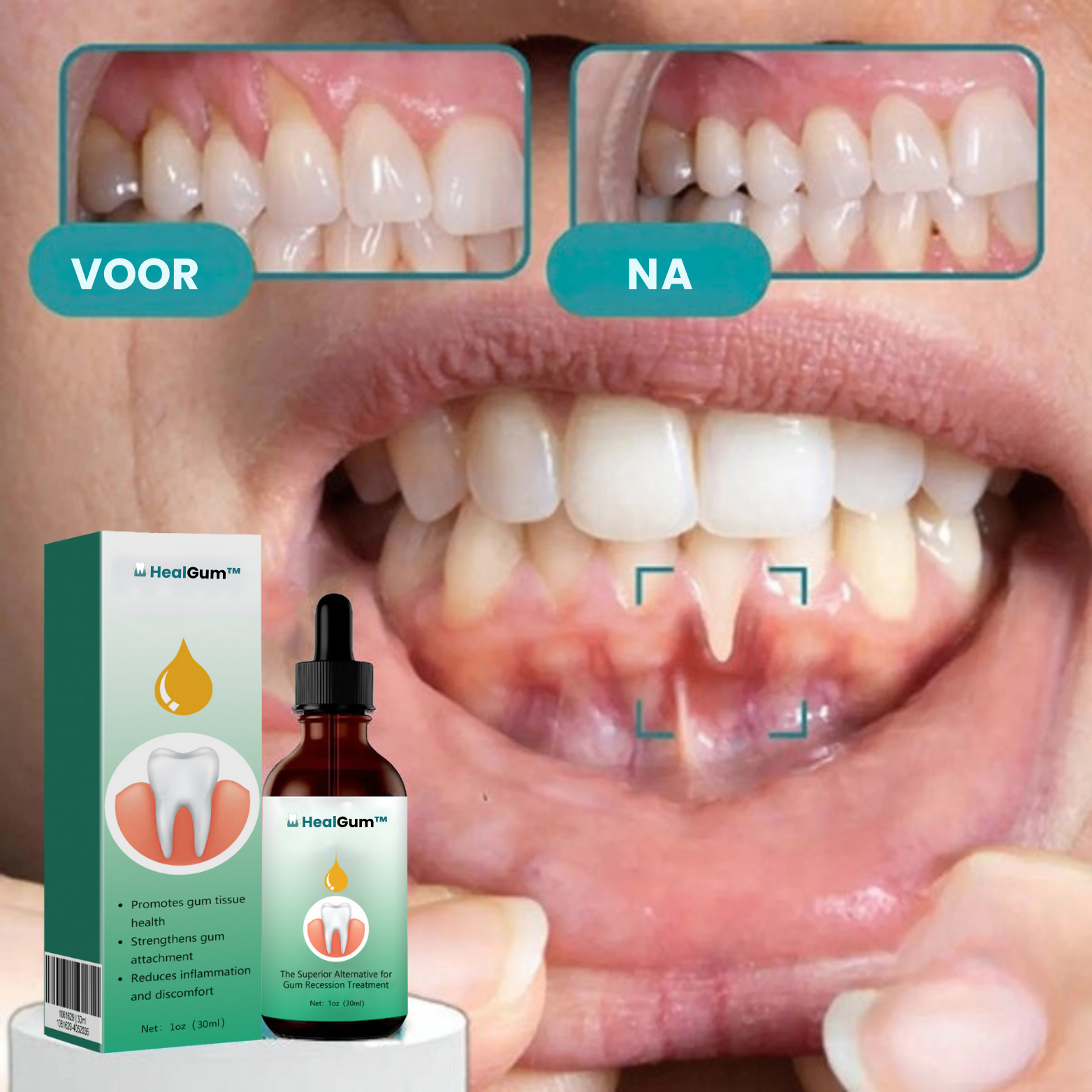 HealGum™ Tandvleesherstel Druppels