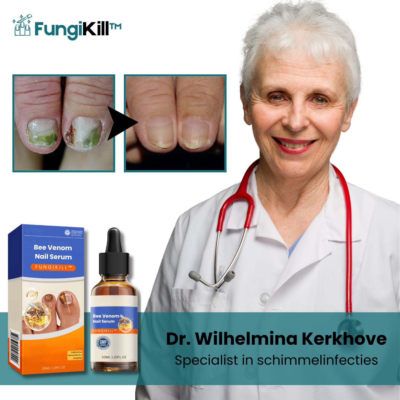 FungiKill™ Bijengif Nagelserum