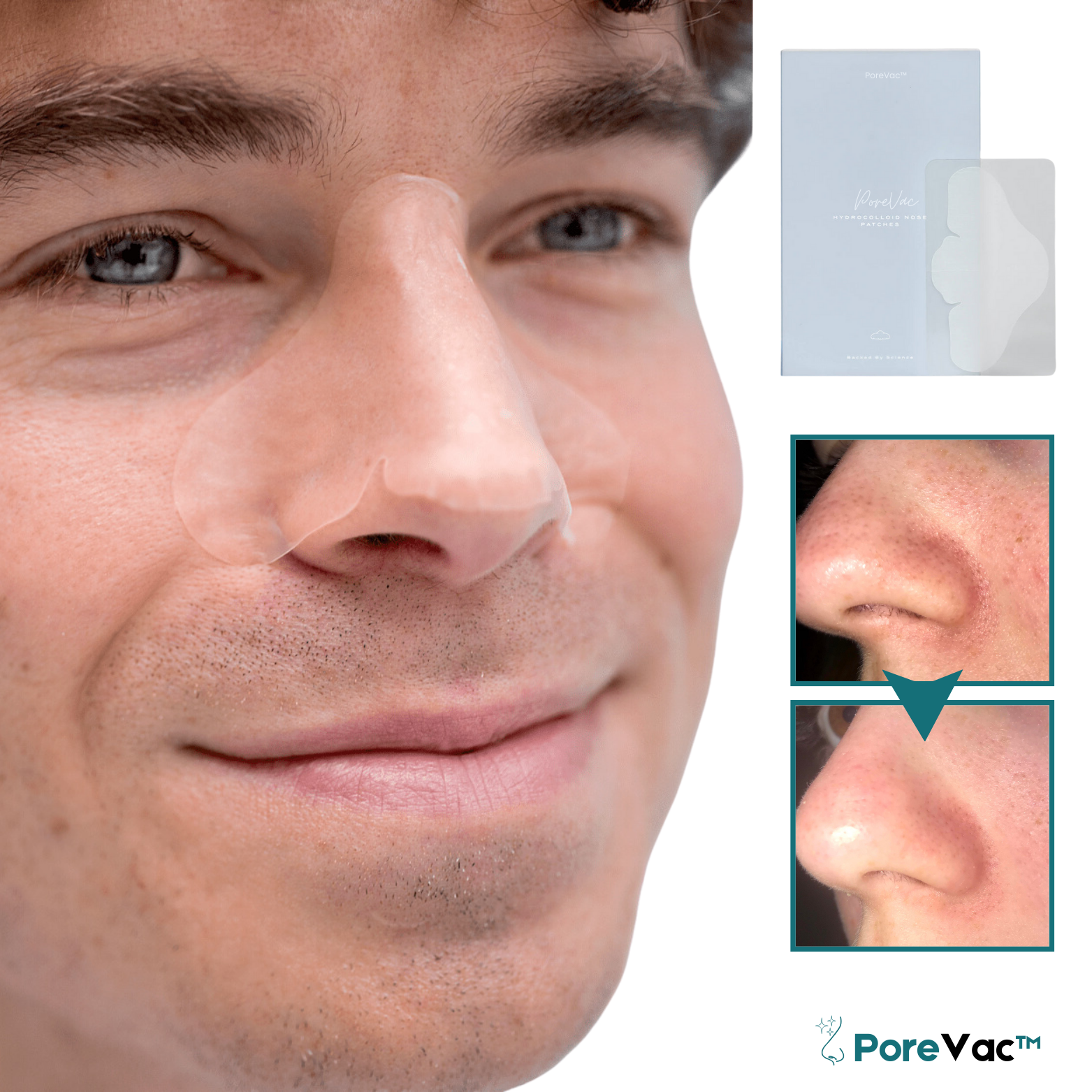 PoreVac™ Hydrocolloid Neuspatches