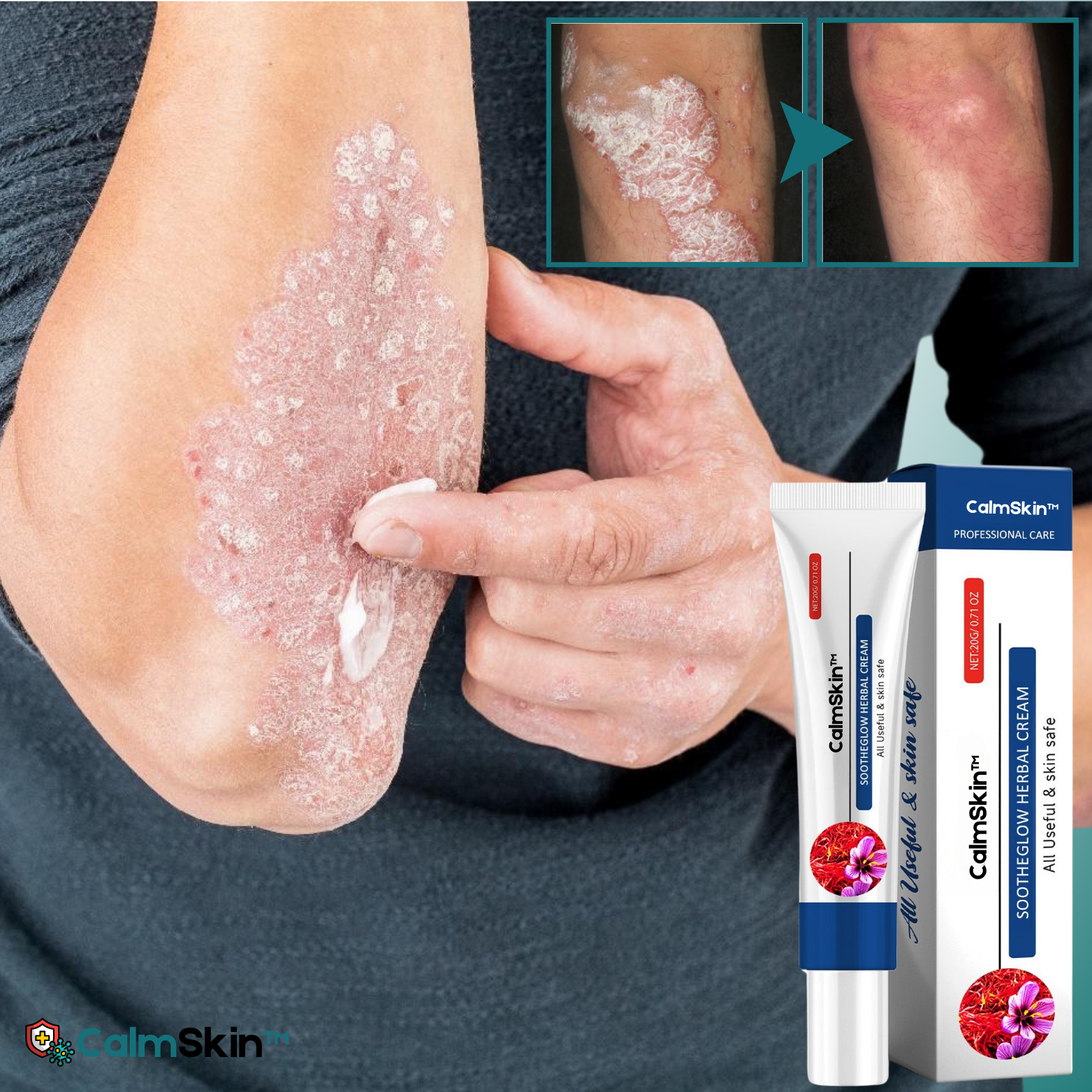 CalmSkin™ Geavanceerde Kruidenherstellende Crème
