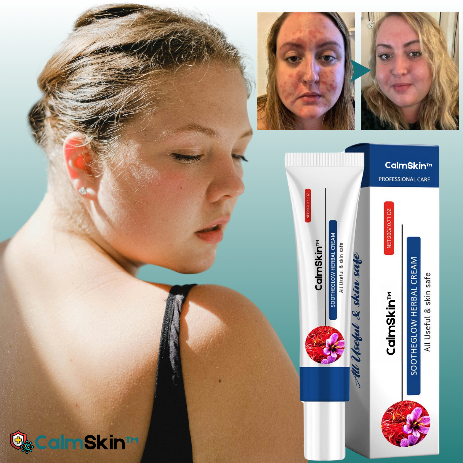 CalmSkin™ Geavanceerde Kruidenherstellende Crème