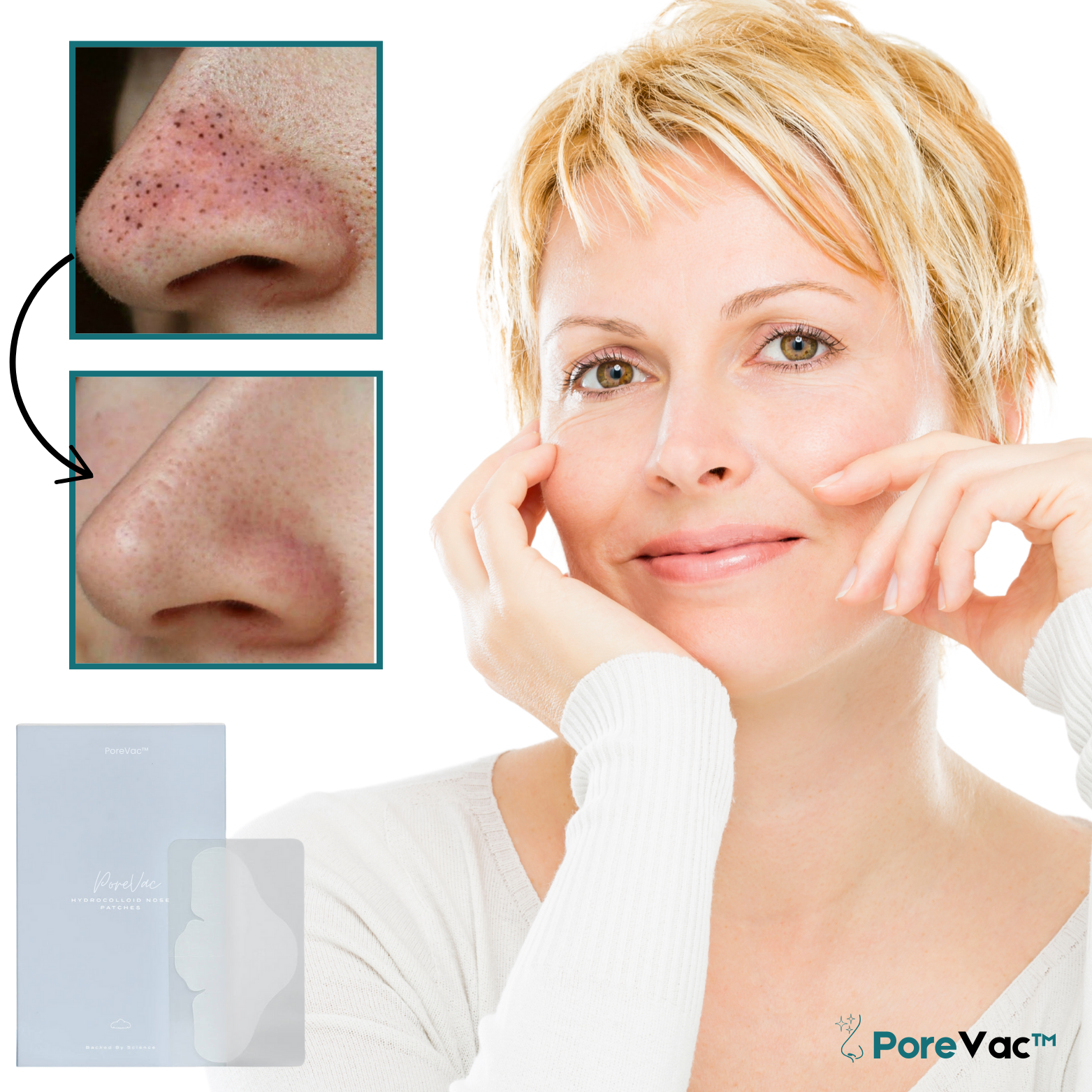 PoreVac™ Hydrocolloid Neuspatches