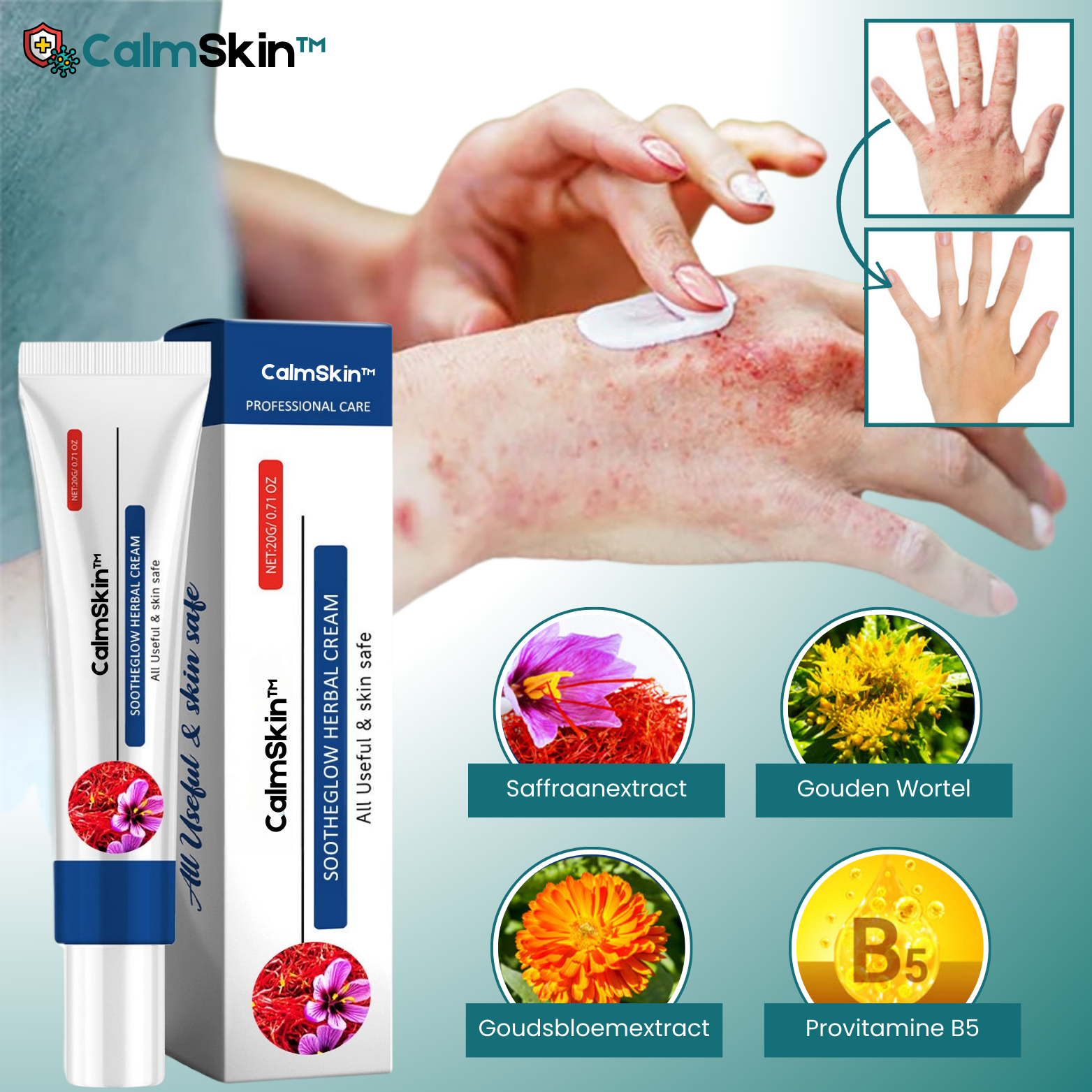CalmSkin™ Geavanceerde Kruidenherstellende Crème