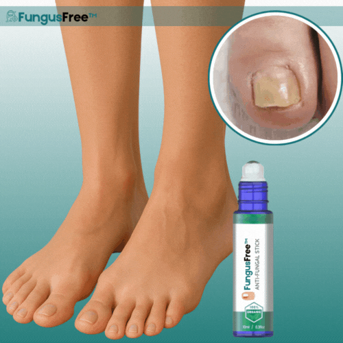 FungusFree™ Geavanceerde Schimmelnagelstick