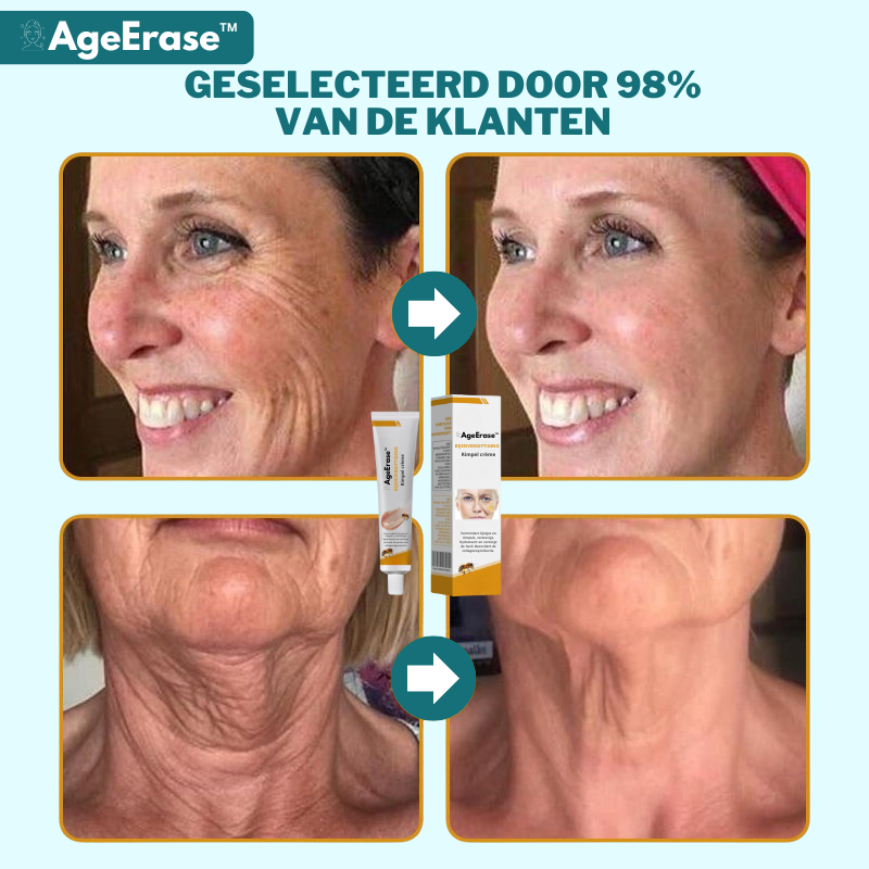 AgeErase™ Botox Bijengifcrème