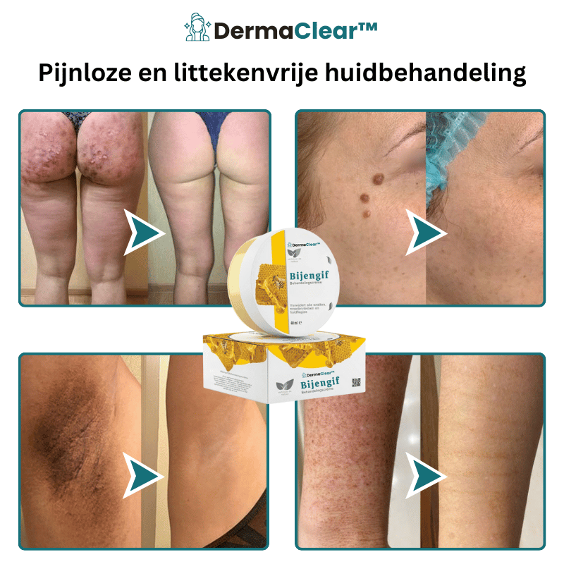 DermaClear™ Huidbehandelingscrème