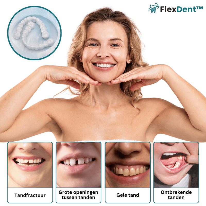FlexDent™ Vormbare Gebitsprothesen
