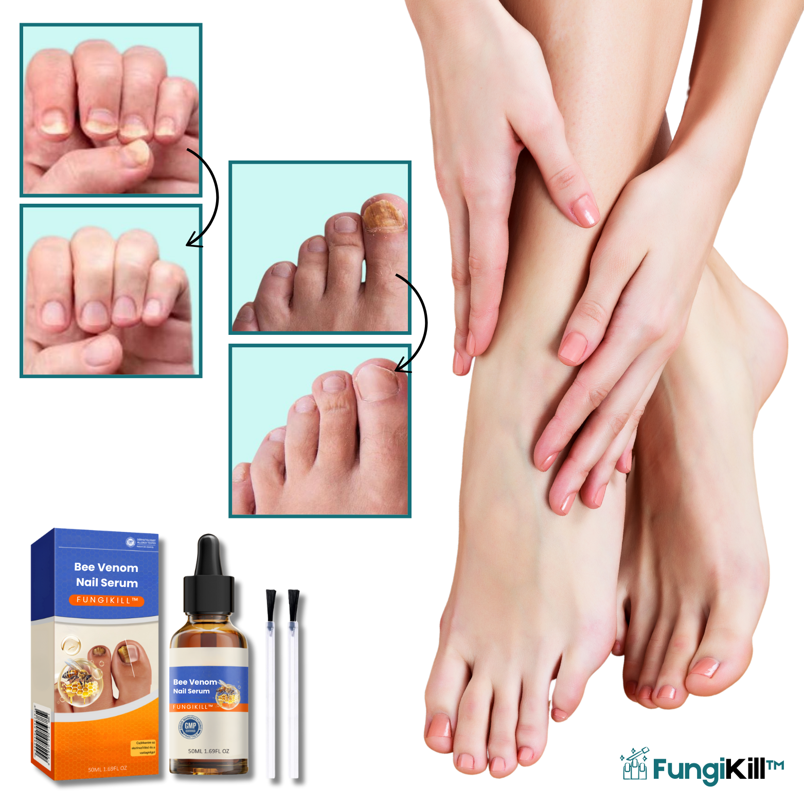 FungiKill™ Bijengif Nagelserum