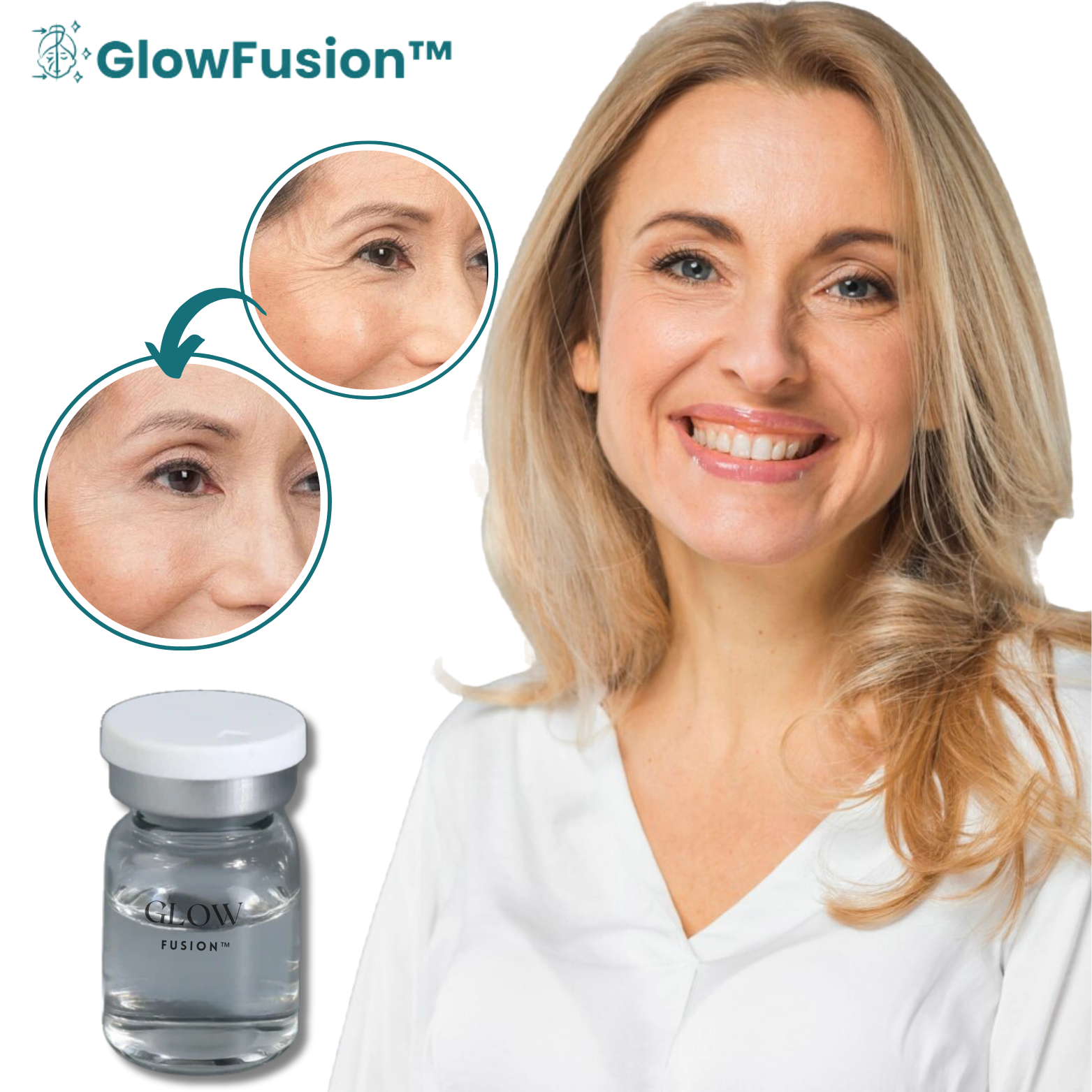 GlowFusion™ Micro Infusie Systeem