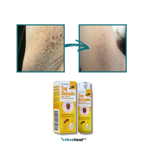 HiveHeal™ Bijengif Huidtag Spray