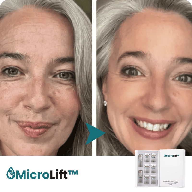 MicroLift™ Micro-Infusiesysteem
