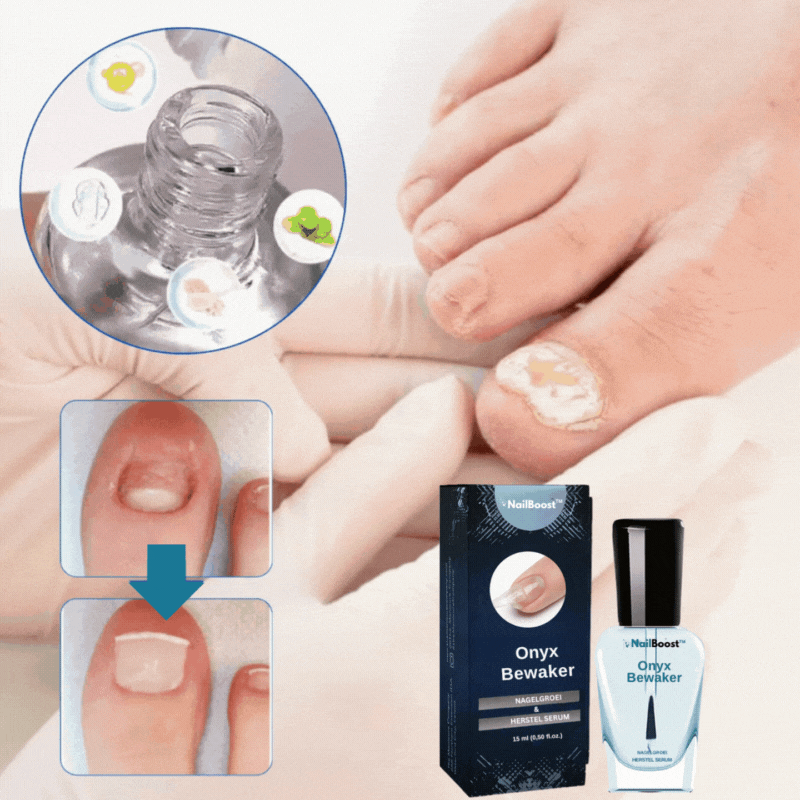 NailBoost™ Nagelserum|