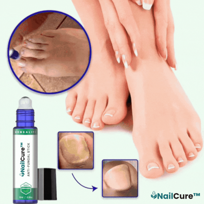 NailCure™ Anti-schimmel Roll-on