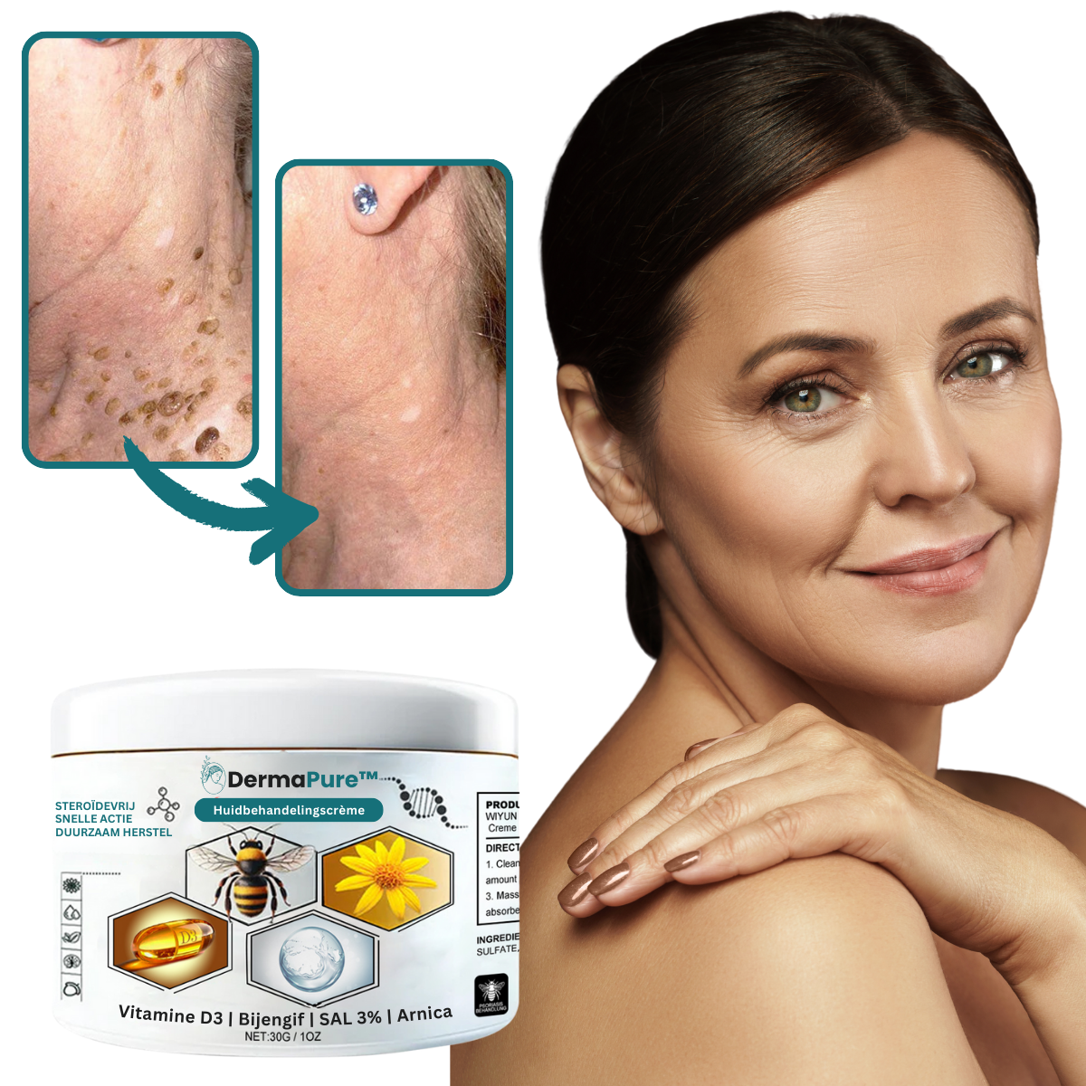 DermaPure™ Huidbehandelingscrème - Test