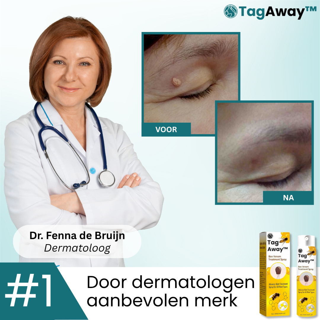 TagAway™ Behandelingsspray