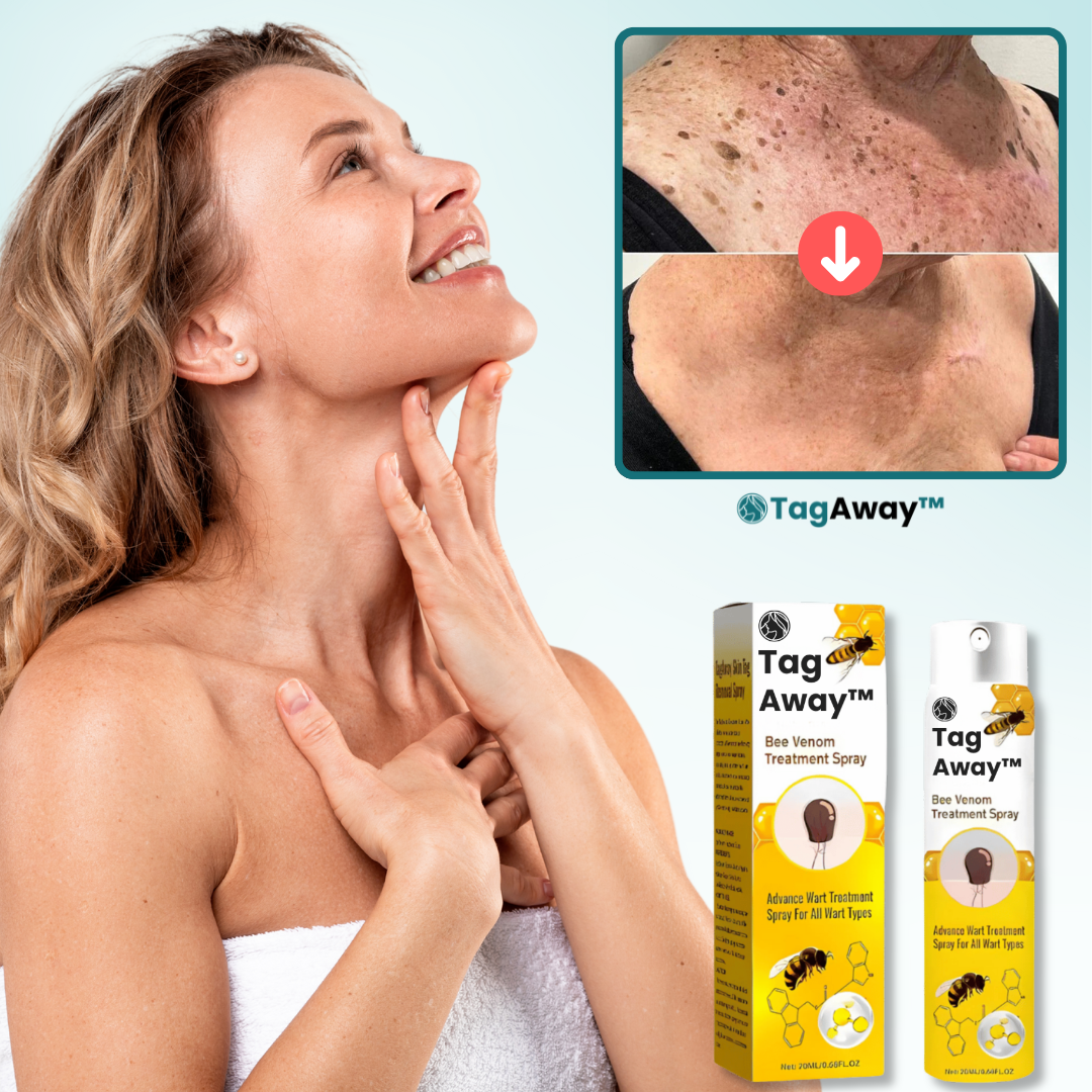TagAway™ Behandelingsspray